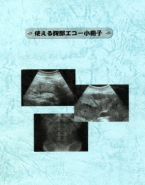 �g���镠���G�R�[�@�����q��